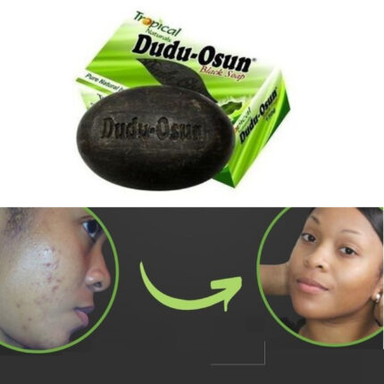 dudu osun black soap