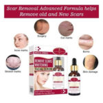 Aichun Beauty Remove Scars Whitening Facial Serum-Kojic Acid&VitaminE,30ml - Image 2